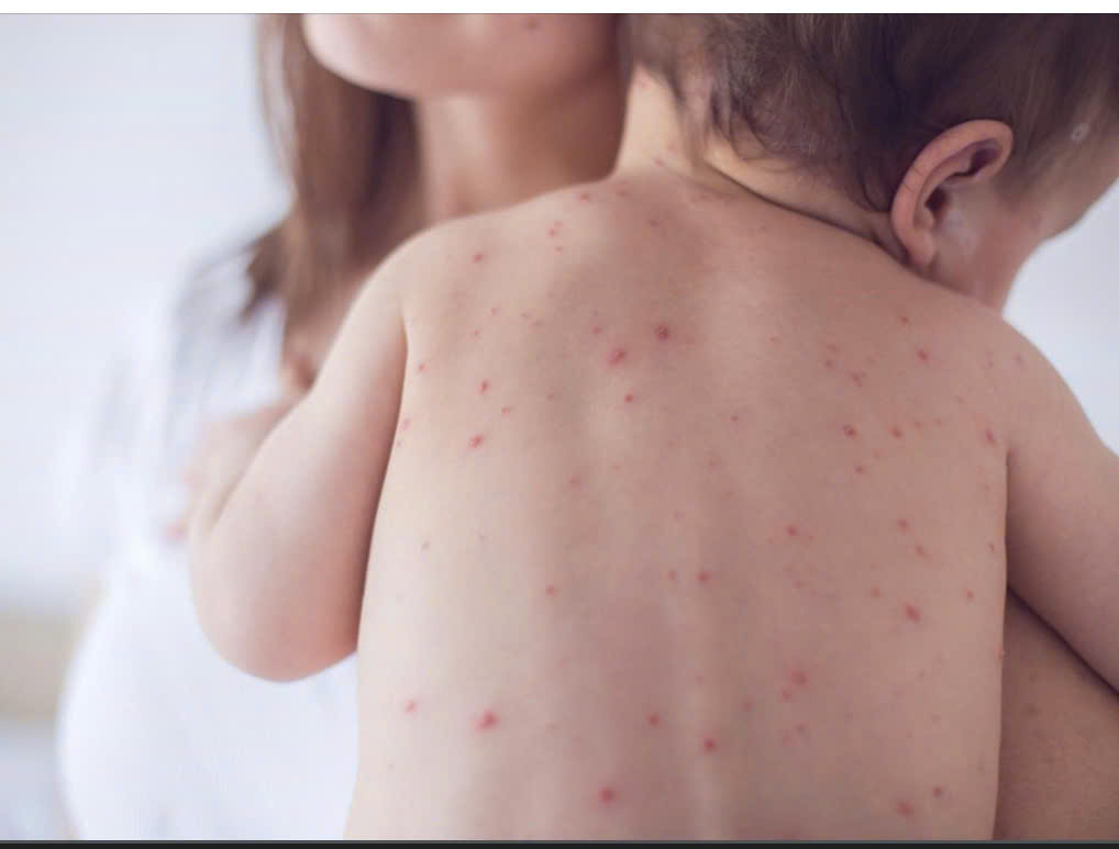 z7686435236093 4a08771c38ce04e22c08d8b8cb996ecf